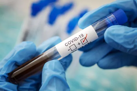 У США заявили про приховування правди щодо COVID-19: розвідка оприлюднила резонансні матеріали