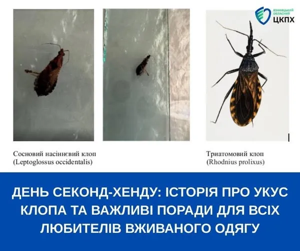 Плюс одна фобия: в вещах из секонд-хэнда скрываются переносчики смертельных заболеваний - today.ua