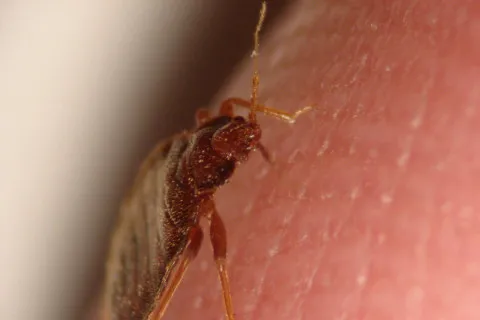 Плюс одна фобия: в вещах из секонд-хэнда скрываются переносчики смертельных заболеваний