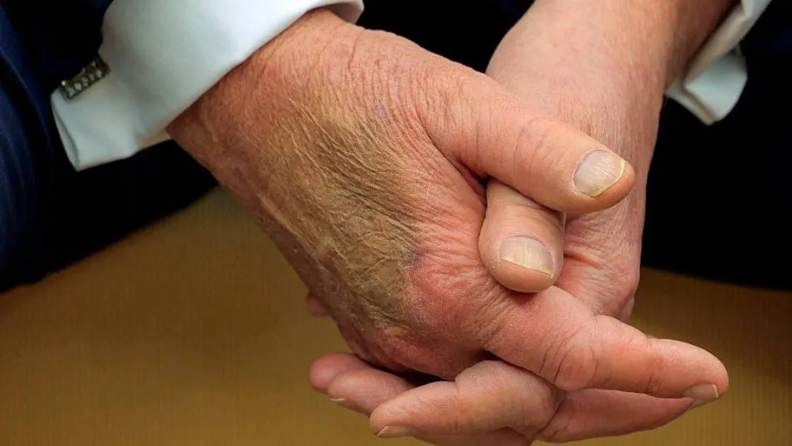 Вэнс готовится стать президентом США: у Трампа серьезные проблемы со здоровьем - today.ua