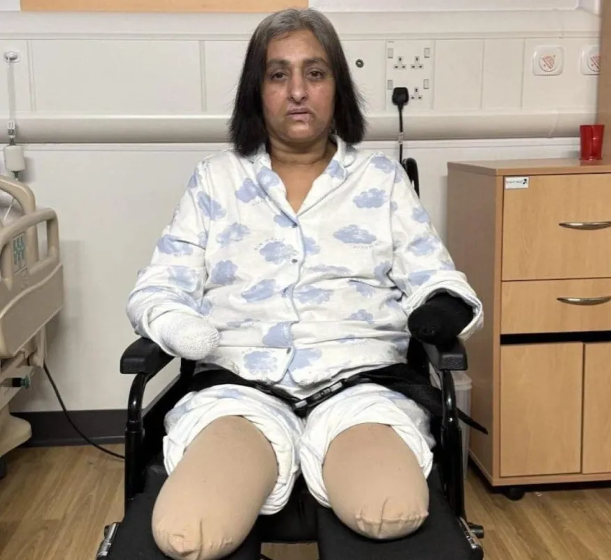 Шість зупинок серця та кома: після гри з собакою жінці ампутували всі кінцівки - today.ua