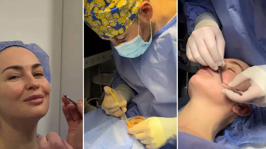 Звезда Дизель Шоу избавилась от пикантной родинки: после пластики ее трудно узнать (фото) Звезда Дизель Шоу избавилась от пикантной родинки: после пластики ее трудно узнать (фото) - today.ua