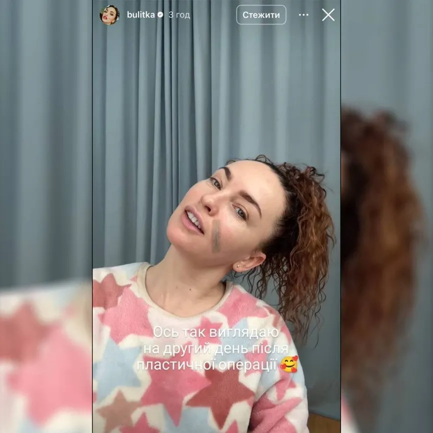 Звезда Дизель Шоу избавилась от пикантной родинки: после пластики ее трудно узнать (фото) Звезда Дизель Шоу избавилась от пикантной родинки: после пластики ее трудно узнать (фото) - today.ua