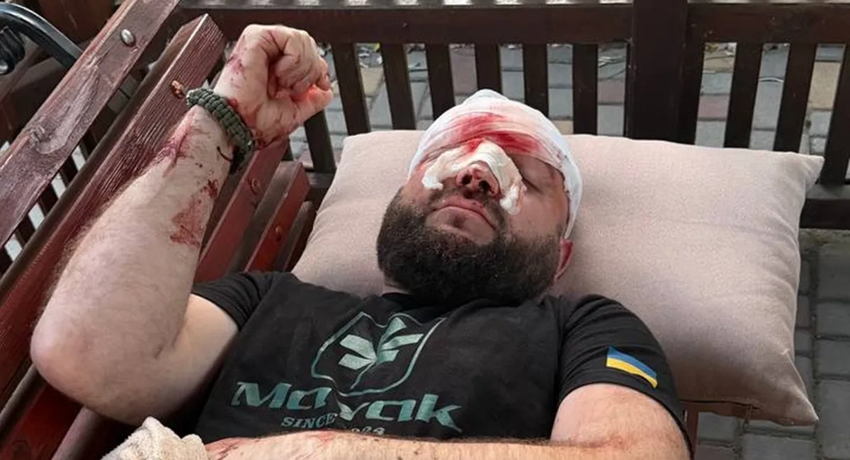 Душил арматурой на глазах у детей из-за треков РФ: в Одесской области известный мажор искалечил военного ВСУ (видео) - today.ua