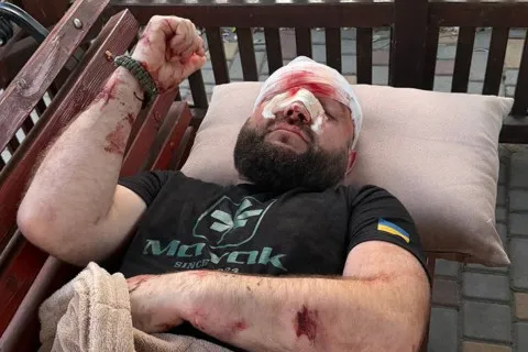 Душил арматурой на глазах у детей из-за треков РФ: в Одесской области известный "мажор" искалечил военного ВСУ (видео)