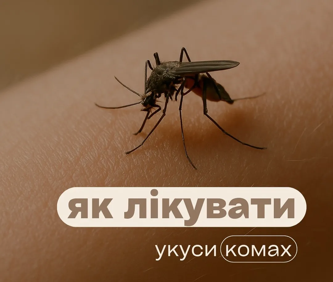 Как лечить укусы насекомых: дерматолог назвала важные правила для взрослых и детей - today.ua