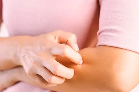 Как лечить укусы насекомых: дерматолог назвала важные правила для взрослых и детей