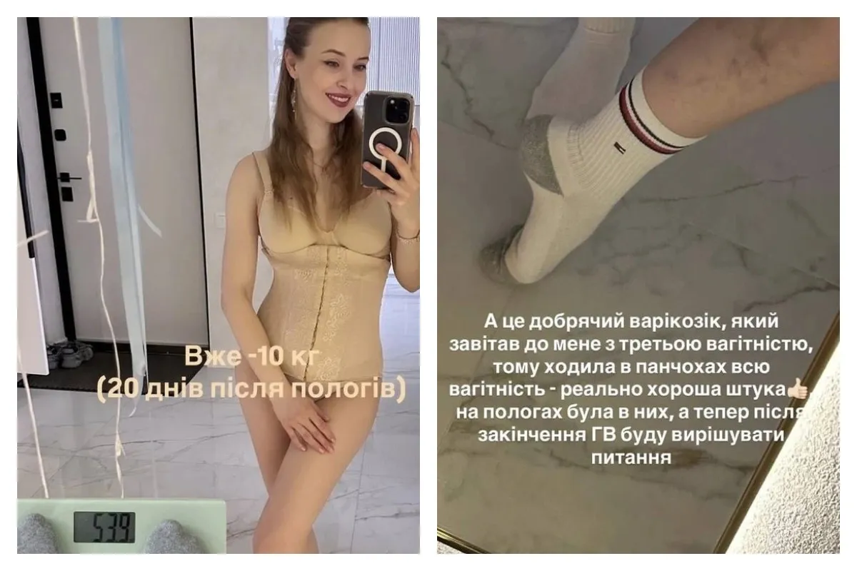Сагайдачная: -10 кг за 20 дней после родов, но есть проблемы со здоровьем Сагайдачная: -10 кг за 20 дней после родов, но есть проблемы со здоровьем - today.ua