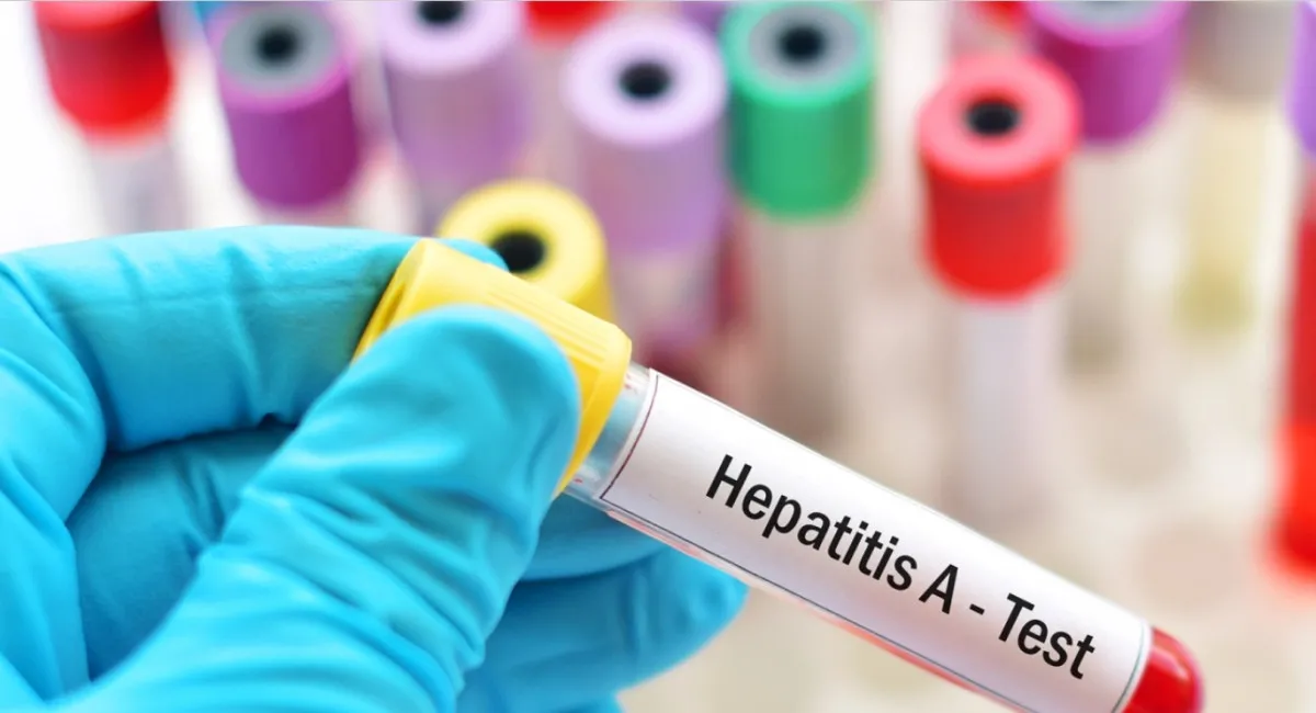 Врач назвала первые симптомы гепатита А и способ уберечь ребенка от болезни - today.ua