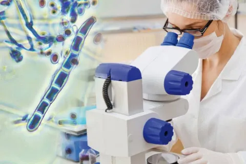 Устойчивый к лекарствам и чрезвычайно заразный: в Европе распространяется новый "супергрибок"