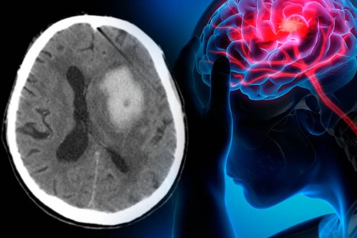 Сердца не выдерживают войну: Украину накрыла волна инсультов и сердечных приступов - today.ua