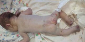 “Немовля жорстоко побили“: у лікарню на Миколаївщині підкинули дитину - today.ua