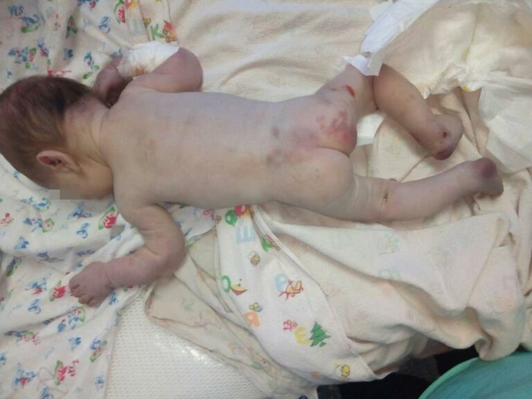 “Немовля жорстоко побили“: у лікарню на Миколаївщині підкинули дитину - today.ua