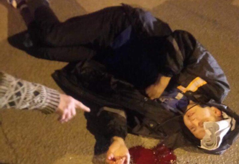 Невідомі у Дніпрі проломили голову паркувальнику