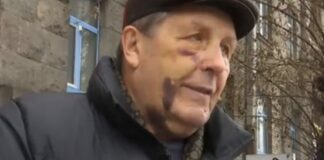 Жестокое избиение авиаконструктора в Киеве: под подозрение попали полицейские - today.ua