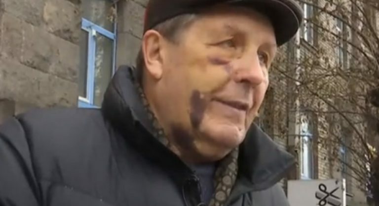 Жестокое избиение авиаконструктора в Киеве: под подозрение попали полицейские - today.ua