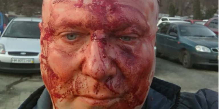 В Киеве жестоко избили известного догхантера Святогора - today.ua