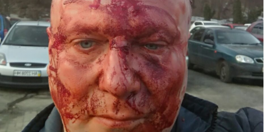 У Києві жорстоко побили відомого догхантера Святогора
