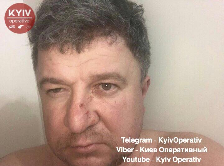 В Киеве пьяный мужчина избил жену и выбросил из окна собаку на глазах у детей - today.ua
