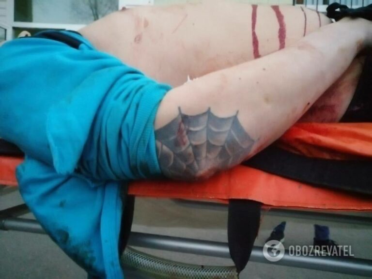 В Киеве решение квартирного вопроса закончилось убийством - today.ua