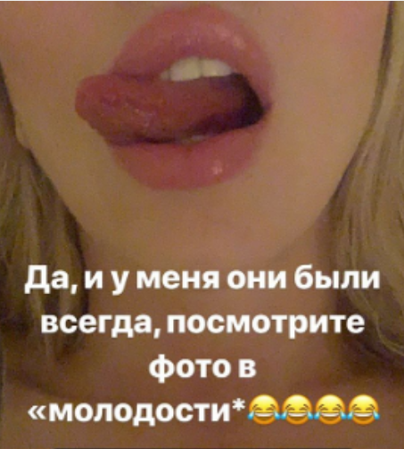 Оля Полякова прокоментувала чутки про збільшення губ
