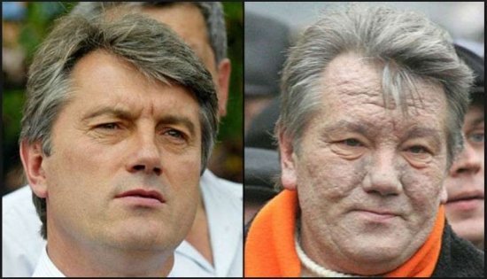 Отравления Ющенко не было: Матиос шокировал новым заявлением
