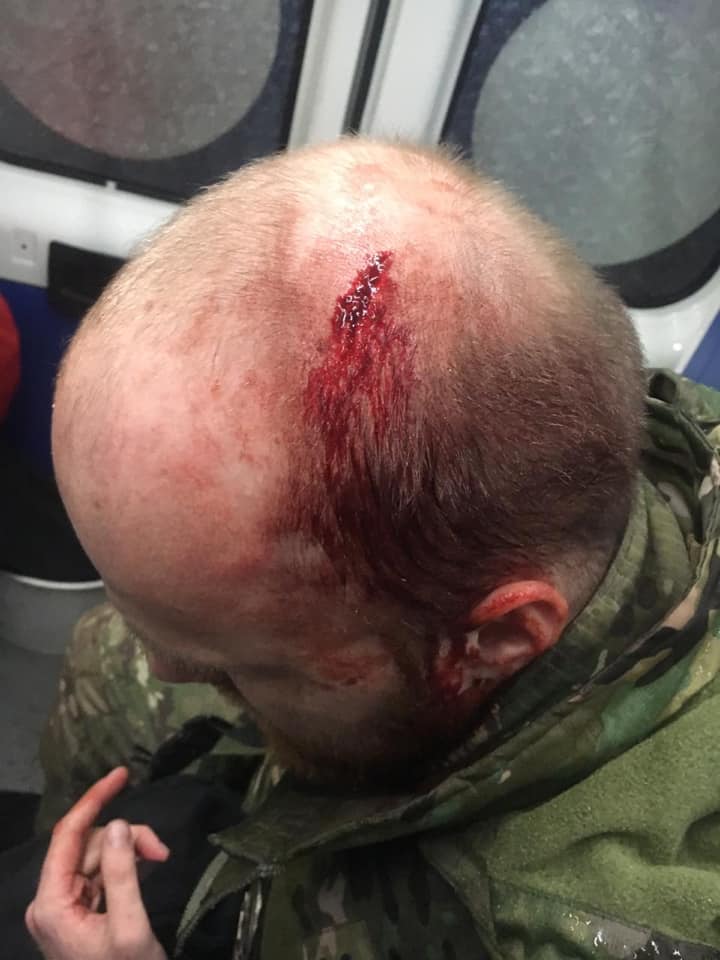 Пробито голови: Цигани, затримані за грабежі на київському вокзалі, влаштували бійню з поліцейськими