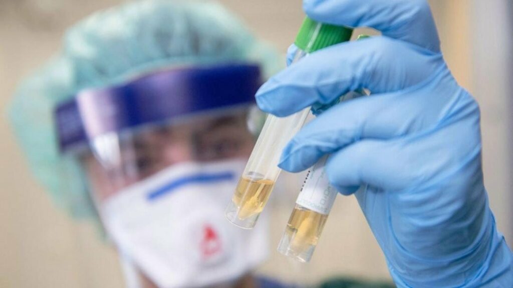 Україна входить у пік захворюваності коронавірусом: оновлені дані МОЗ на 29 березня
