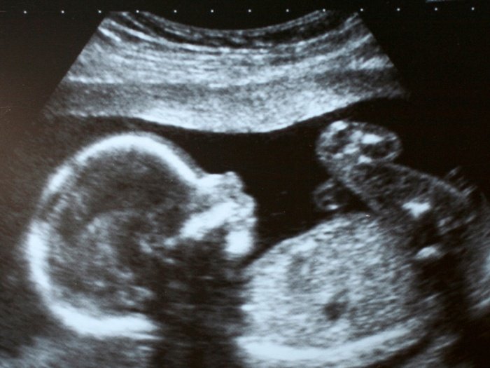 Коронавірус у новонародженого немовляти в Британії – усе дуже серйозно