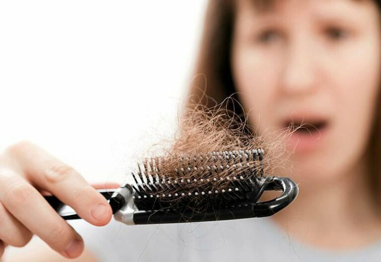 Выпадение волос: лучшие натуральные средства для борьбы с этой проблемой - today.ua