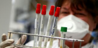 Тестування на коронавірус в Україні: МОЗ перерахувало, кого перевірять безкоштовно  - today.ua