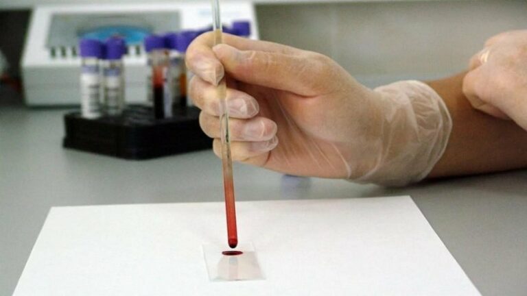 Яка група крові переважає у хворих коронавірусом  - today.ua