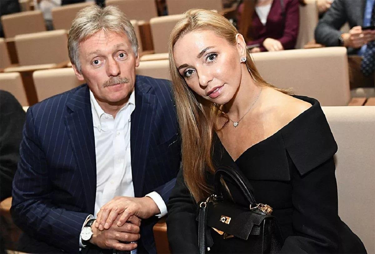 Навка розповіла про боротьбу Пєскова з коронавірусом: "Ще в лікарні"