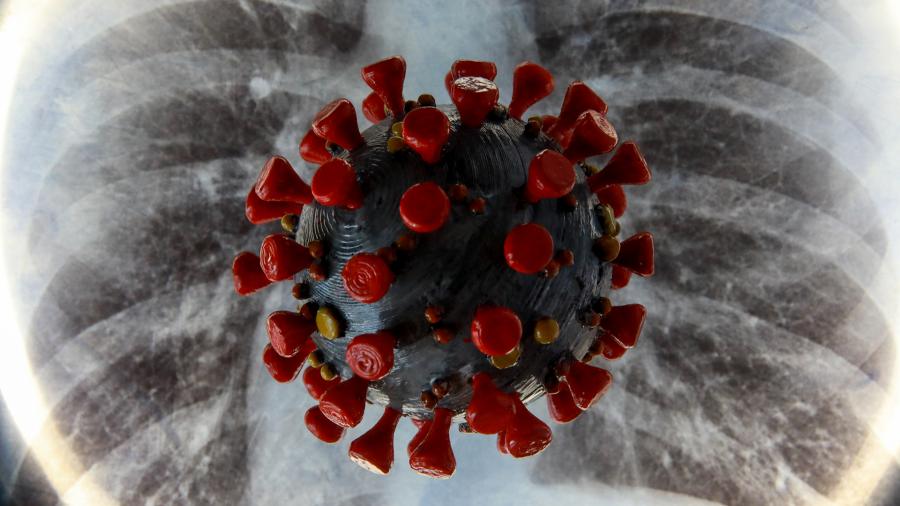 Як коронавірус вражає легені: медики дали поради по відновленню