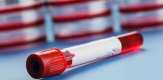 Коронавирус и группа крови: ученые подтвердили, что представители одной их групп заражаются чаще остальных    - today.ua