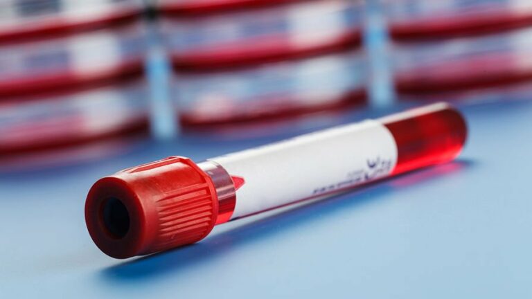 Коронавирус и группа крови: ученые подтвердили, что представители одной их групп заражаются чаще остальных    - today.ua