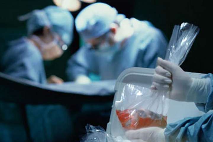Правительство утвердило тарифы на трансплантацию органов: суммы впечатляют