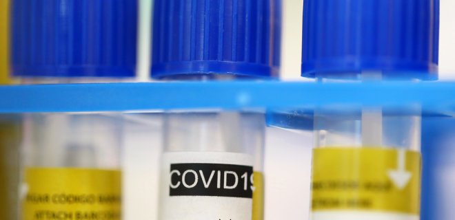 Украина побила новый антирекорд по коронавирусу: количество заболевших превысило 2000 человек - today.ua