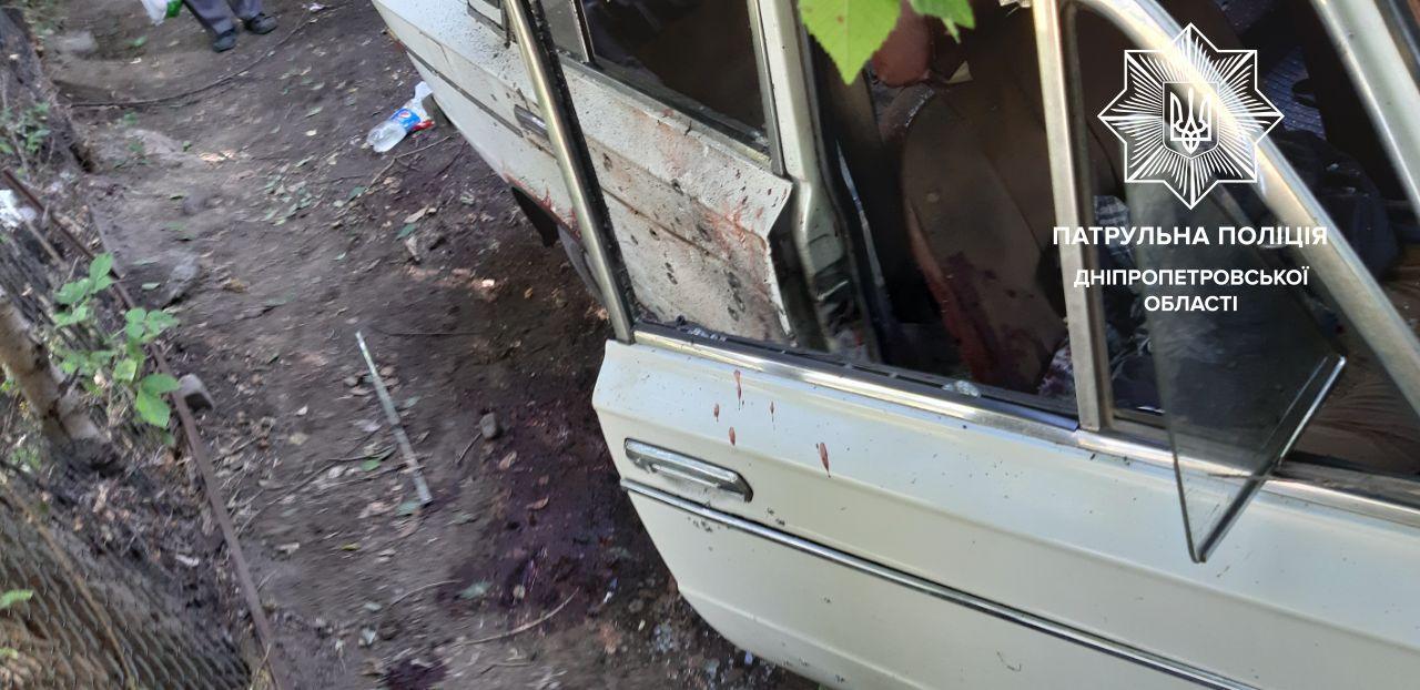 В Днепре в салоне припаркованного автомобиля взорвалась граната: водителю оторвало обе руки