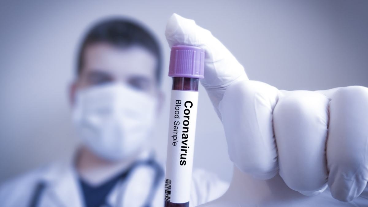 Европейскую вакцину от COVID-19 будут тестировать на украинцах - МОЗ