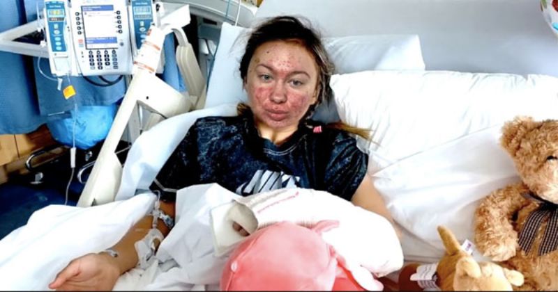 И коронавируса не нужно: 11-летняя девочка из США угодила в больницу после поцелуев с лягушками