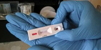 Эксперт назвал вид тестов, которые безошибочно диагностируют новый штамм коронавируса - today.ua