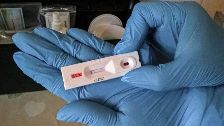 Експерт назвав вид тестів, які безпомилково діагностують новий штам коронавіруса - today.ua