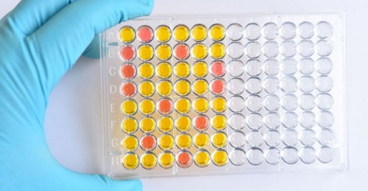 Эксперт назвал вид тестов, которые безошибочно диагностируют новый штамм коронавируса