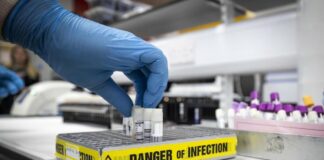 Ученые выяснили, в чем состоит главная опасность британского штамма коронавируса - today.ua