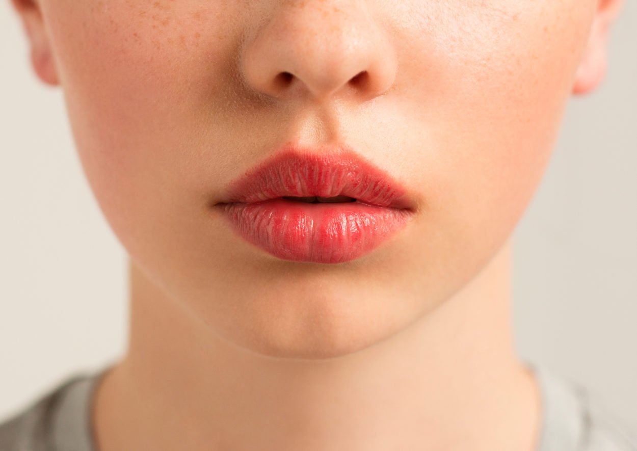 Как бороться с сухостью губ зимой: бьюти-эксперт рассказала, почему не помогает гигиеническая помада