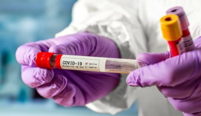 Вакцина от коронавируса уже в Украине: власти потратили почти миллиард гривен - today.ua