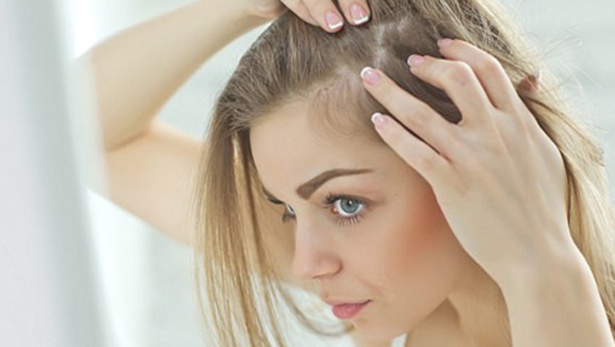 Облысение при коронавирусе: врач объяснила, почему после тяжелой болезни выпадают волосы - today.ua