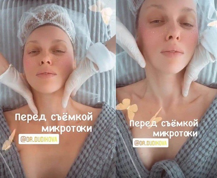 Оля Полякова показала себя без макияжа