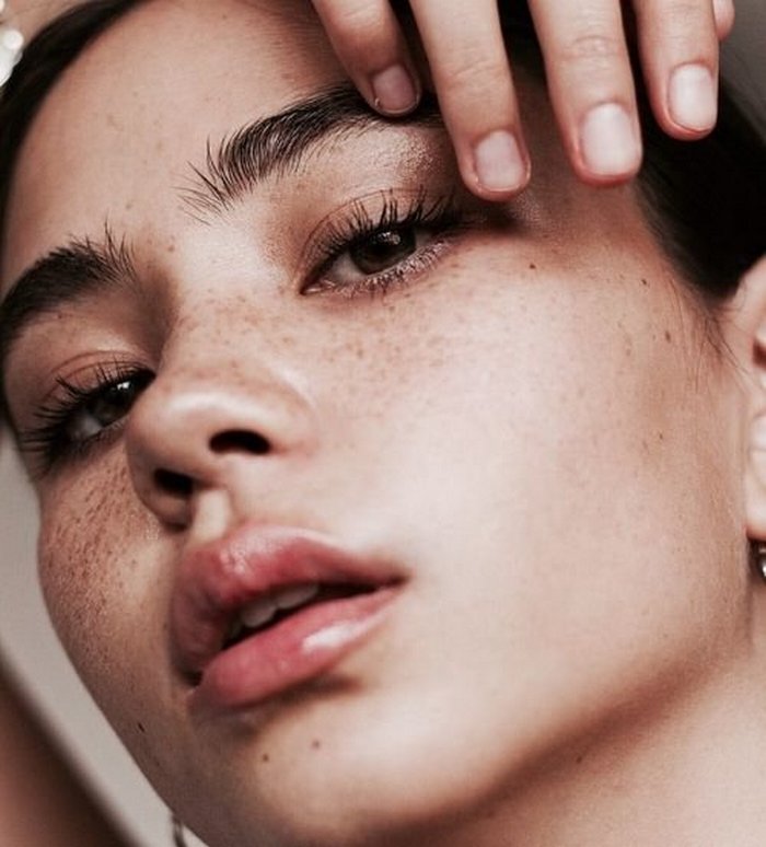 ТОП-4 продукта, из-за которых появляются прыщи на лице - today.ua